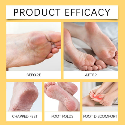 Bee Venom Lymphatic Drainage & Slimming Foot Patches 🌿👣